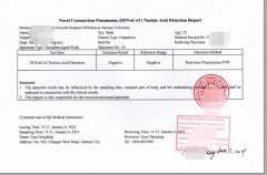 核酸檢測(cè)報(bào)告翻譯有哪些注意要素